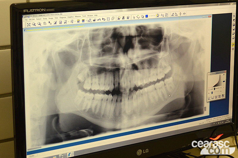 Odontologia Esportiva - 2